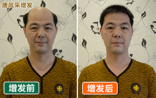 唐風采假發