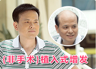 唐風采假發