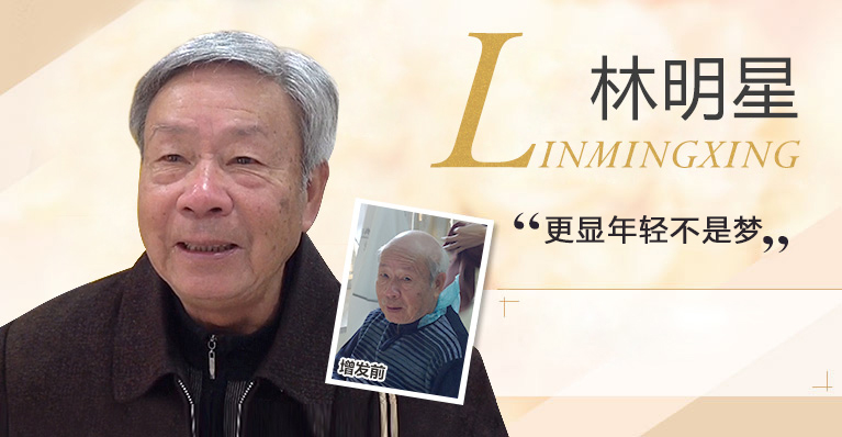 唐風采織發案例-老年男性脫發