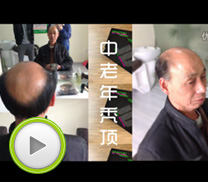中老年織發案例