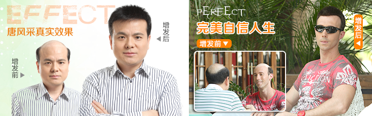 織發補發解決方案