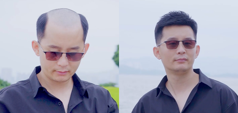 男士假發案例視頻