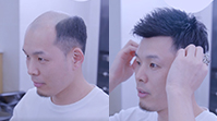 男士禿頂假發案例視頻>>