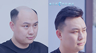 男士假發客戶案例視頻>>