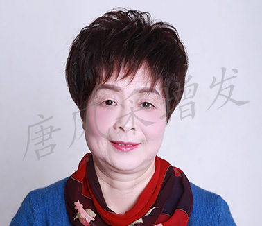 女士頭發稀少增發