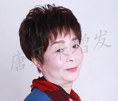 女士頭發稀少增發案例