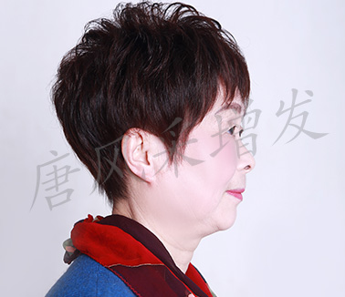 女士頭發稀少增發圖片