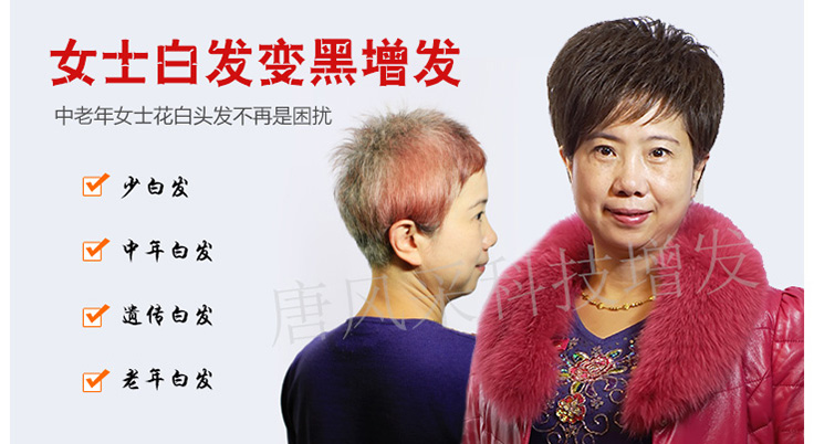 唐風采女士白發變黑