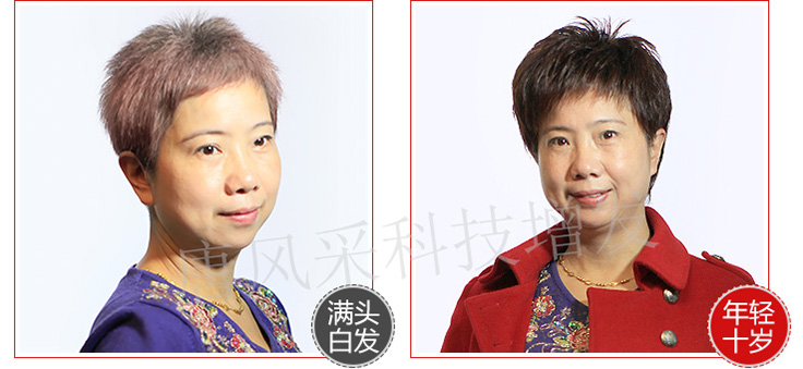 女士白發變黑
