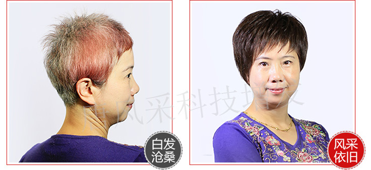 女士白發變黑案例