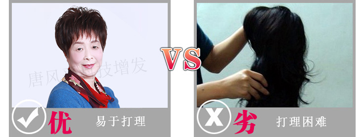 女士頭發稀少增發對比