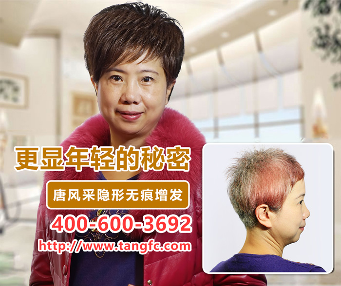 唐風采女士頭發稀少解決方案