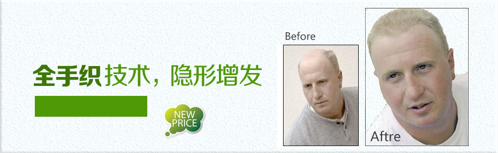 男士假發定做前后對比效果
