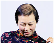 女士頭發稀少