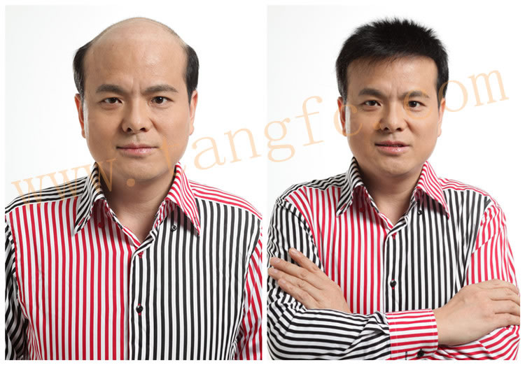 用什么洗頭可以生發?