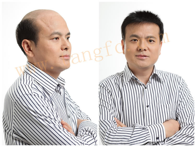 吃什么可以長頭發?