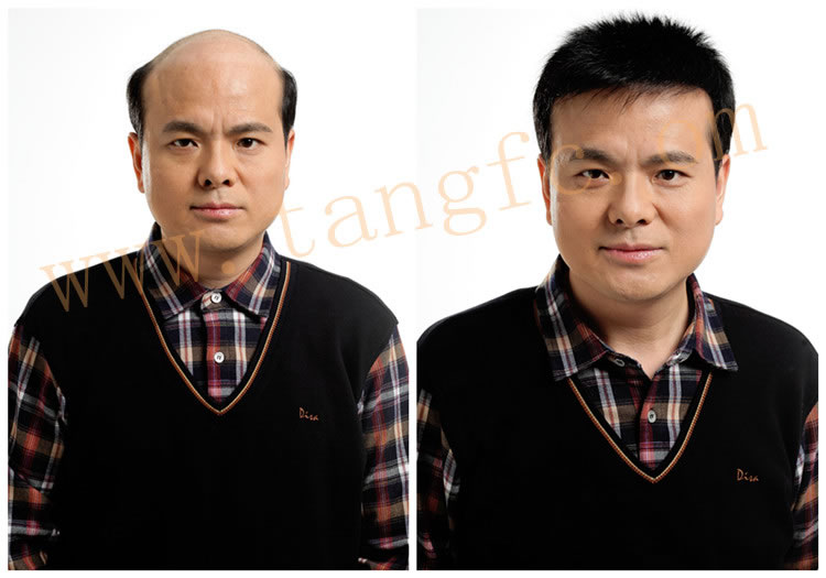 選擇男士假發需要注意什么？