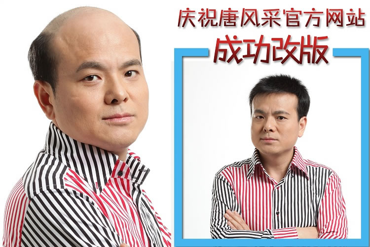 女生不脫發可以做增發么？
