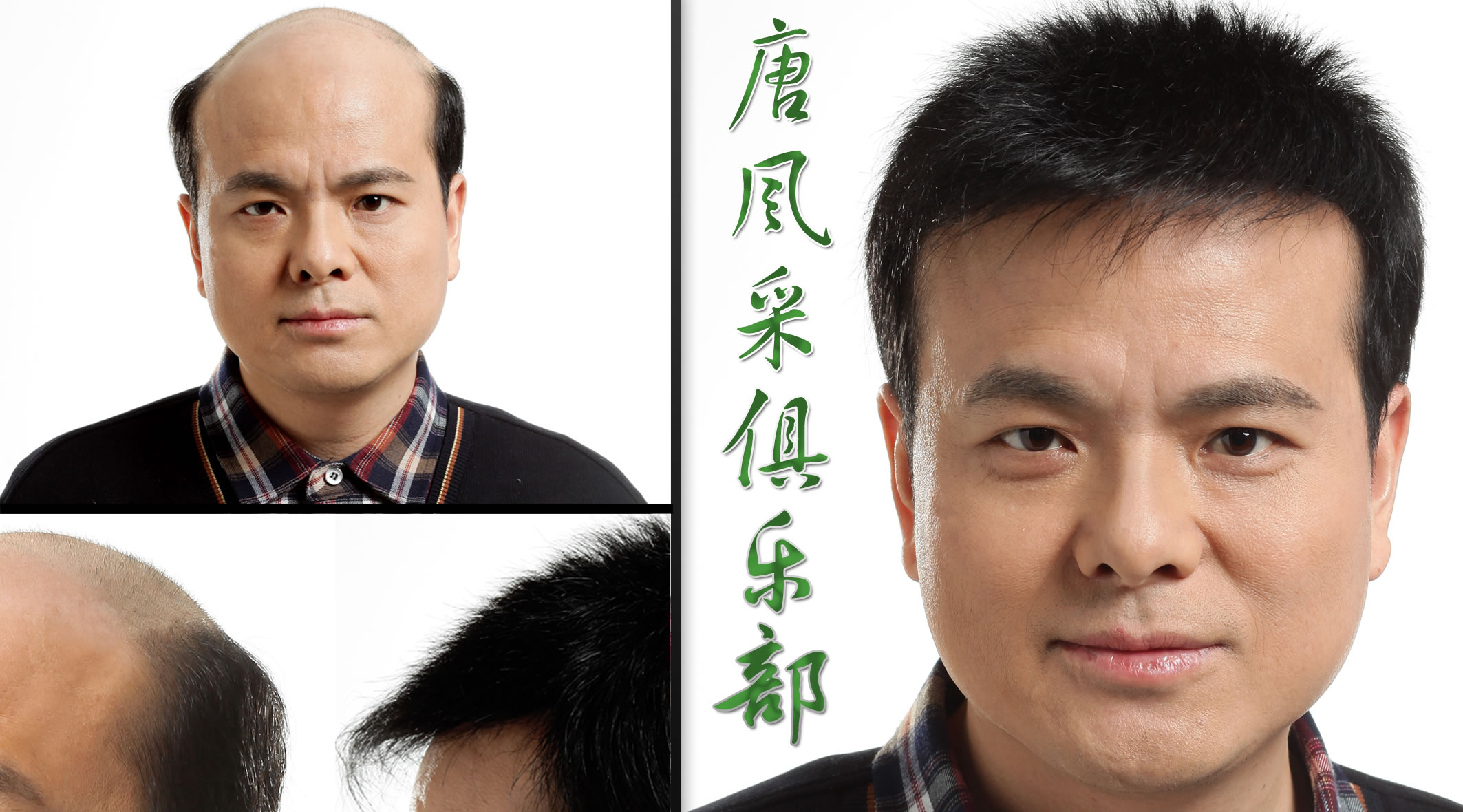增發補發