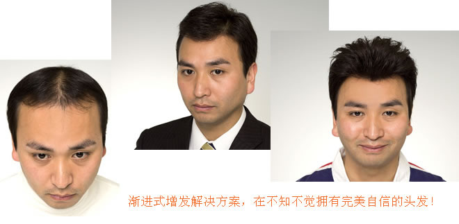 怎么洗頭才不容易脫發？