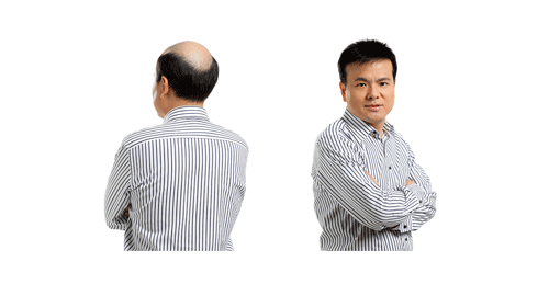 增發前后