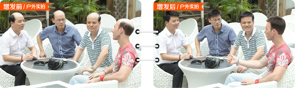 黑發變白怎么辦？
