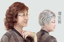 女士織發補發案例