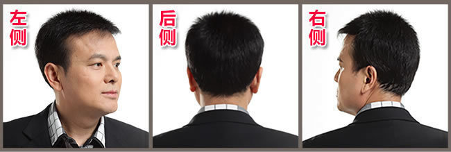 前額兩邊頭發稀疏怎么辦？看了你就知道怎么解決！