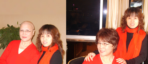 女性頭發(fā)稀疏 女性頭發(fā)稀疏謝頂怎么辦?如果發(fā)體稀疏就要避免這些!