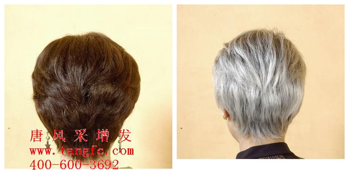 有了白發怎么辦？怎么讓白發變黑發？
