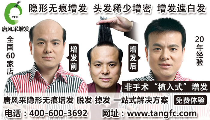 男士補(bǔ)發(fā)價格 補(bǔ)發(fā)會掉嗎?2015男士補(bǔ)發(fā)價格怎么計(jì)算