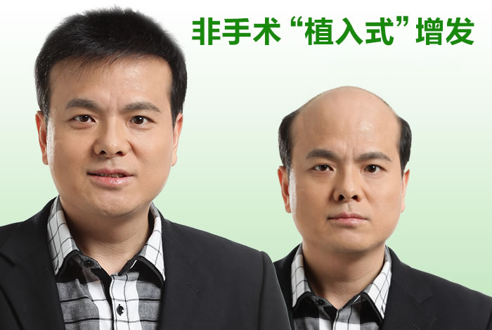 織發(fā)補(bǔ)發(fā)有什么優(yōu)勢(shì) 真人假發(fā)織發(fā)補(bǔ)發(fā)有什么優(yōu)勢(shì)?