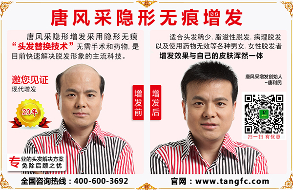 唐風采補發 唐風采補發怎么樣?無手術無藥物百分百根治秀發問題!