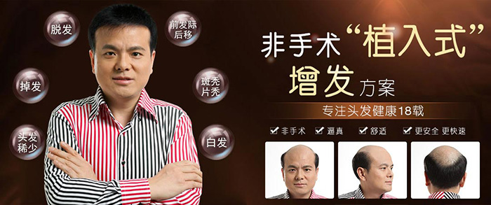 男士頭發稀疏