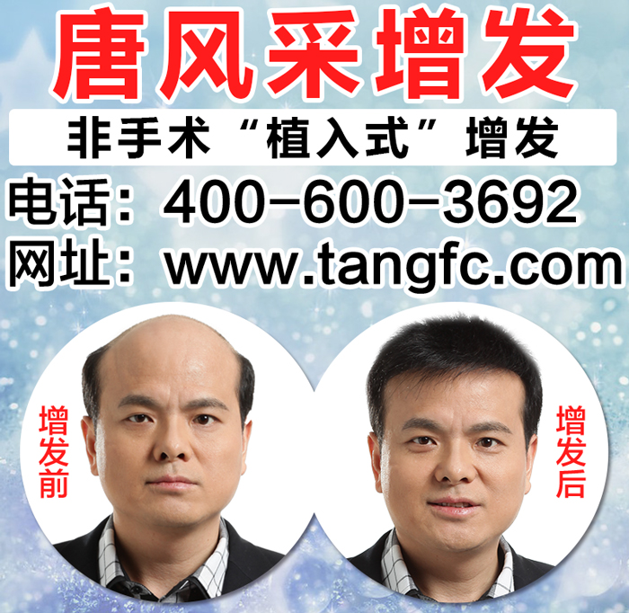 沈陽哪里有織發 沈陽哪里有織發?有需求的往哪里找呢?
