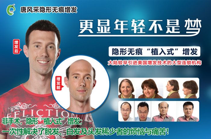 斑禿不要怕，小編帶您見證唐風采效果！