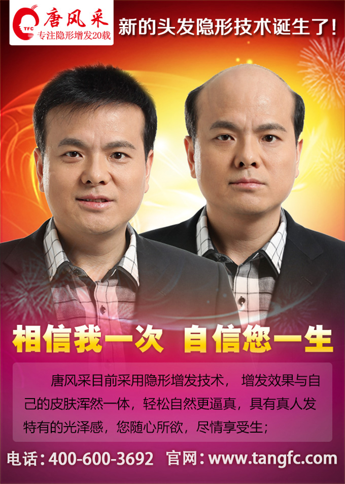 有點禿頂怎么辦 有點禿頂怎么辦,禿頂的原因你知道嗎?