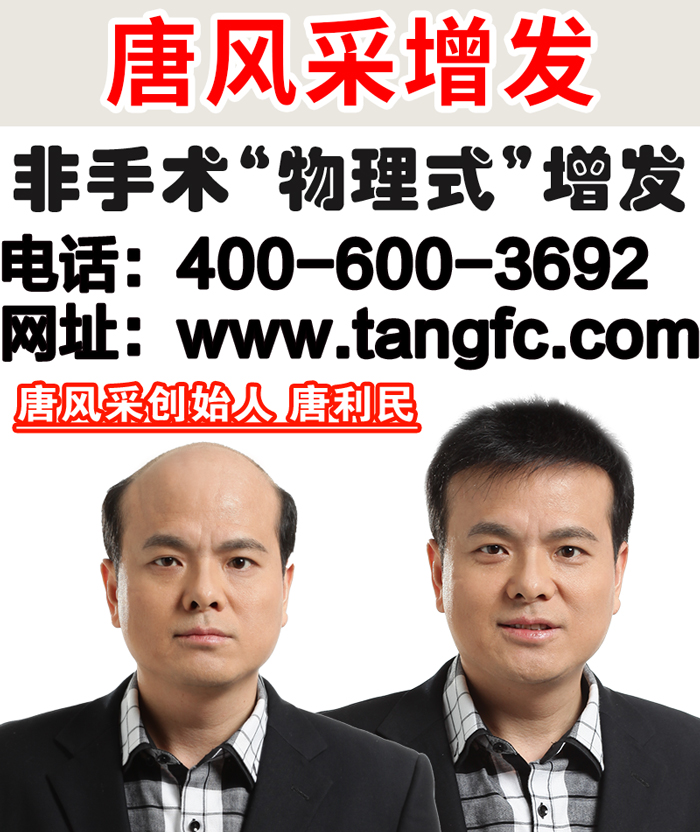 哪種假發好,哪種假發逼真 哪種假發好,哪種假發逼真?唐風采時尚假發當之無愧!