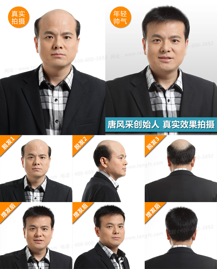 禿頂了，品牌假發定做為你保駕護航