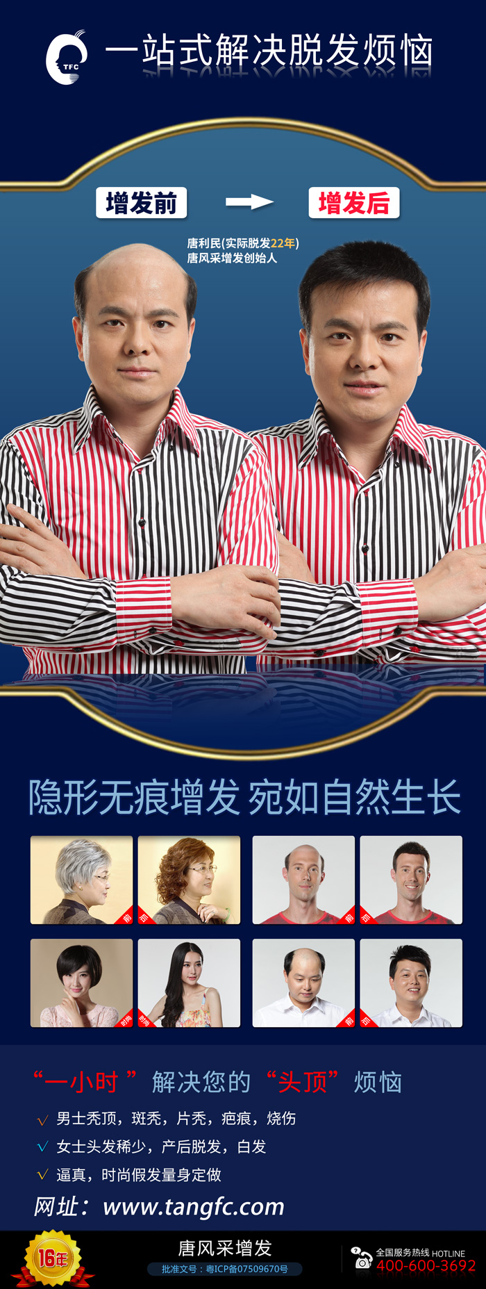 無痕補(bǔ)發(fā)價(jià)格是多少？哪里補(bǔ)發(fā)技術(shù)比較好？