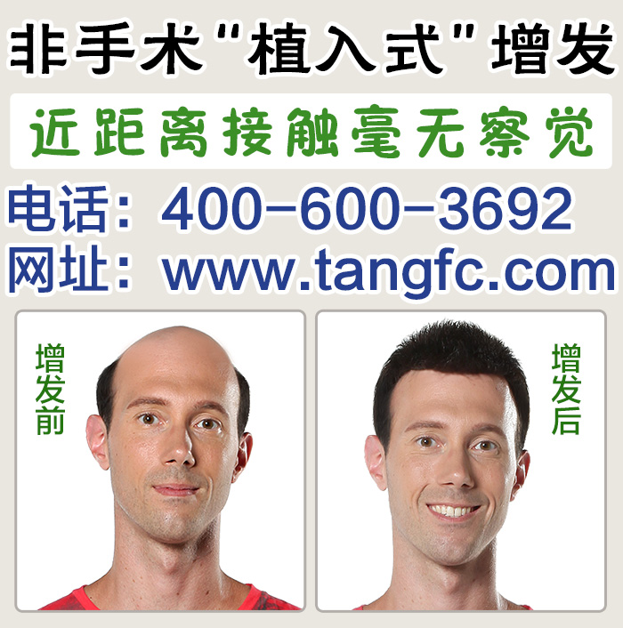 脫發怎么辦？品牌假發定做技術成熟嗎？