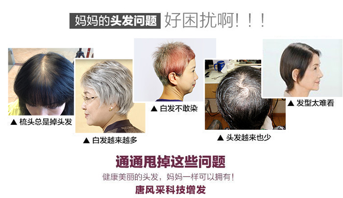 白發脫發 日常習慣要注意,防火防盜防白發脫發!