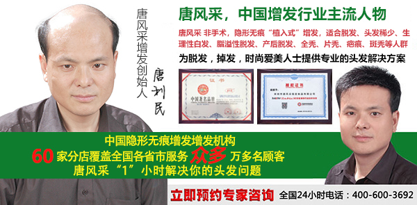 大連自然織發找哪家好 大連自然織發找哪家好?脫發復原就靠這個了!