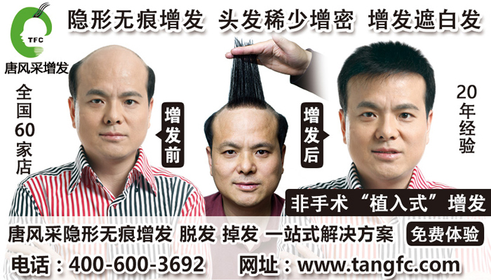 漳州解決頭發稀少 在漳州頭發稀少有地方能解決嗎?
