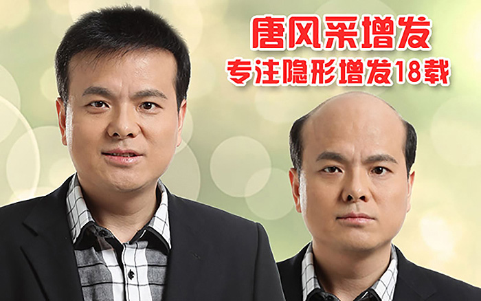 脂溢性脫發(fā)能治好嗎 脂溢性脫發(fā)能治好嗎?專(zhuān)業(yè)機(jī)構(gòu)為你解答發(fā)體癥狀