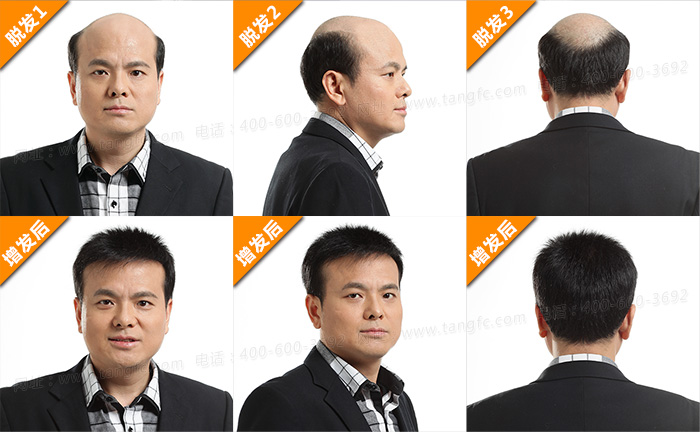 哈爾濱定做男士假發 哈爾濱哪有可以定做男士假發的?