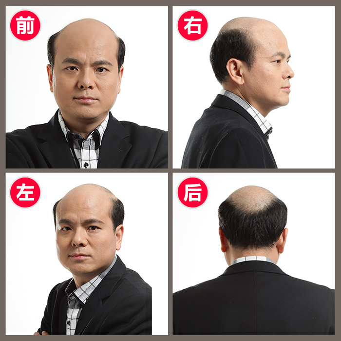 男生假發一般多少錢 男生假發一般多少錢?教你最短時間選擇男生假發