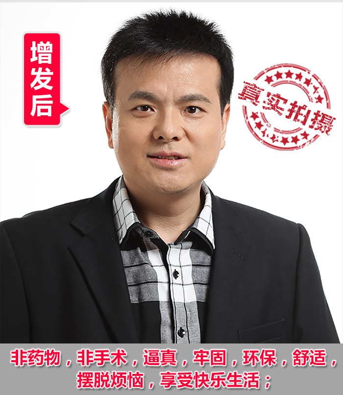 佛山假發(fā)專賣店 脫發(fā)禿頂?shù)目诵恰鹕剿饺硕ㄖ聘叨思侔l(fā)!