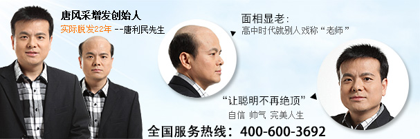 嘉興哪有買假發 嘉興哪有買假發?想從頭開始的請看這!