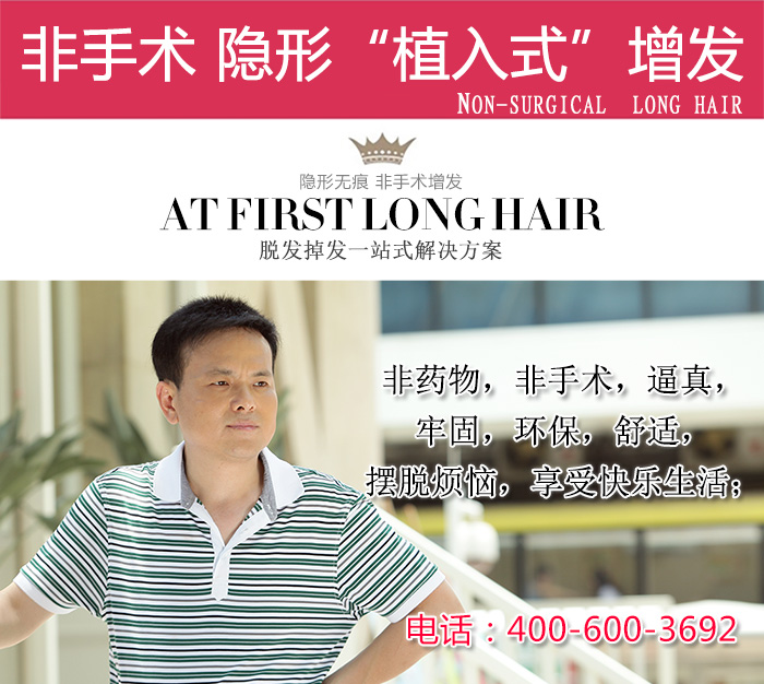 廈門哪里有量身定做假發的機構？定制假發的優勢